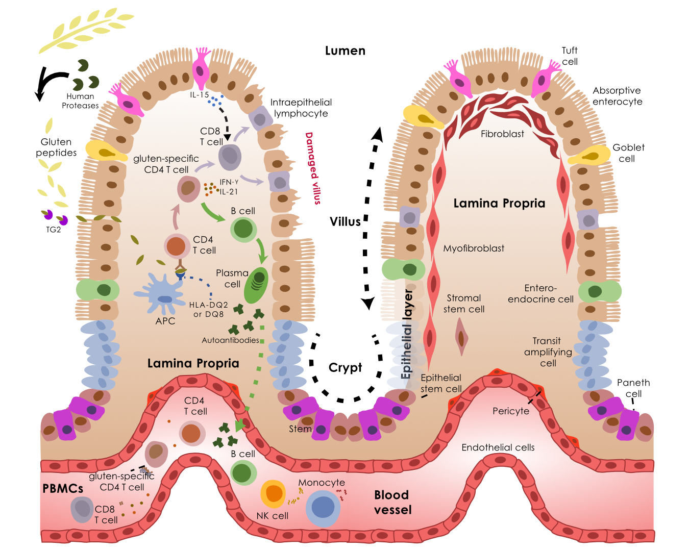 Immunopathogenesis of Celiac Disease